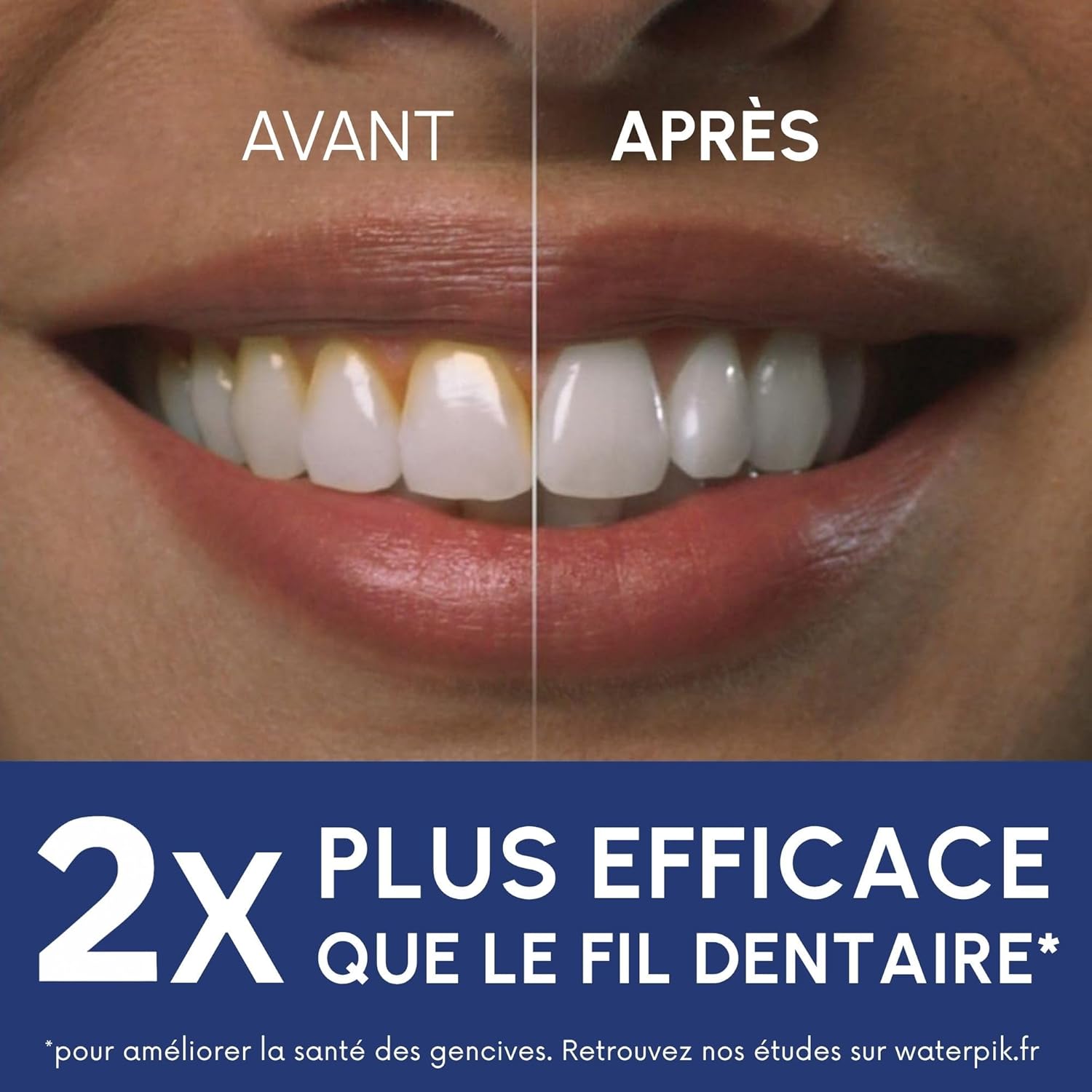 Waterpik – Hydropulseur Ultra professionnal, Jet dentaire avec 6 embouts et 10 niveaux de pression, Élimine la plaque, Blanc (WF-660EU)